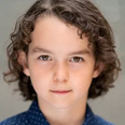 Calix Fraser