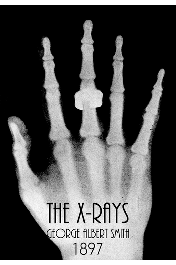 de Curta The X-Ray Fiend (1897)