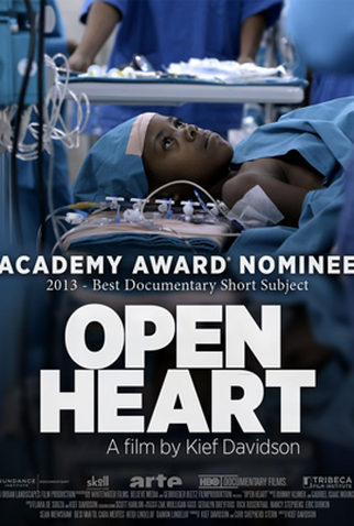 Poster 1 de Curta Open Heart (2013)
