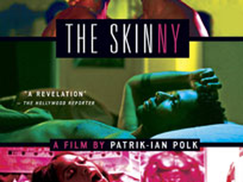 Foto 1 de The Skinny