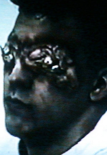 Esophagus (Esophagus)