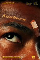 Sunburn (Sunburn)