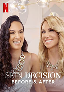 Operação Autoestima: Antes e Depois (1ª Temporada) (Skin Decision: Before and After (Season 1))