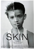 Skin (Skin)