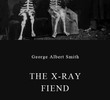 The X-Ray Fiend