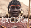 Excision