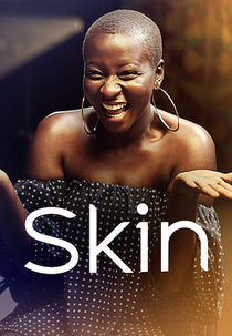 Skin (Skin)