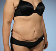 Super Fupa