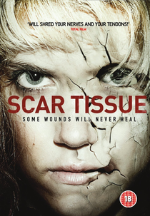 Scar Tissue (Scar Tissue)