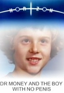 Dr Money e o garoto sem pênis (Dr Money and the Boy with No Penis)
