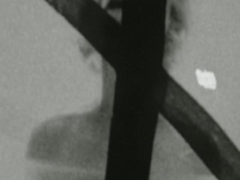 Foto 1 de Filmarilyn