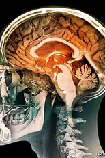 Seu Cérebro é Masculino ou Feminino? (Is Your Brain Male or Female?)