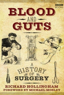 A História da Cirurgia - Por dentro do Cérebro - Poster / Capa / Cartaz - Oficial 1