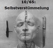 10/65: Selbstverstümmelung