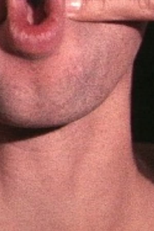 Pinchneck (Pinchneck)
