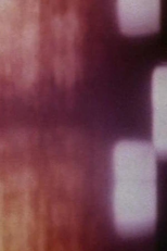 Bad Burns (Bad Burns)