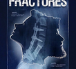 Fractures