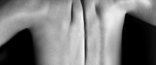 Febre do Rato (2011)