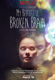 My Beautiful Broken Brain (My Beautiful Broken Brain)