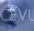 Nœvus