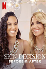 Operação Autoestima: Antes e Depois (1ª Temporada) (Skin Decision: Before and After (Season 1))