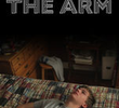 The arm