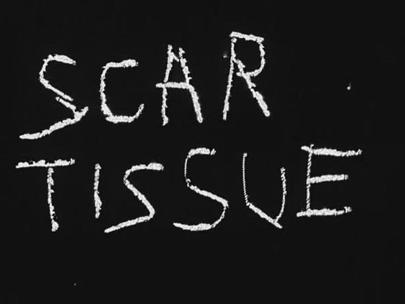 Foto 1 de Scar Tissue