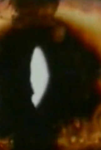 Poster 1 de Curta Wound Footage (2003)