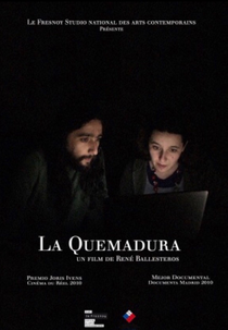 A Queimadura (La Quemadura)