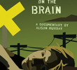 Train on the Brain
