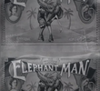 The Elephant Man Revealed