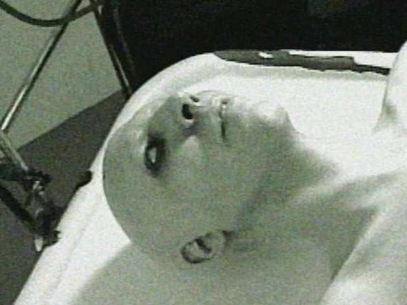 Foto 2 de Marilyn Manson: Autopsy