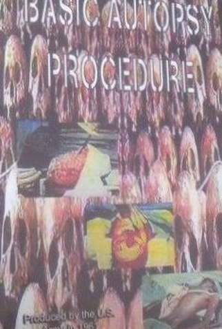 Poster 1 de Filme Procedimentos Básicos de Autópsia (1961)