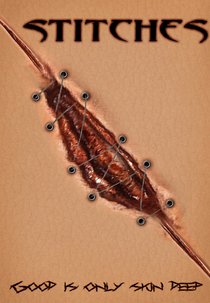 Stitches (Stitches)