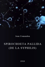Spirochoeta pallida (de la syphilis) (Spirochoeta pallida (de la syphilis))