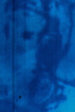 Rayures (Rayures, effacement / Disparition) (Rayures (Rayures, effacement / Disparition))