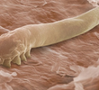 Your Skin