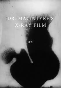 Dr. Macintyre’s X-Ray Film (Dr. Macintyre’s X-Ray Film)