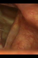 Jimi Hendrix e a Fonoaudióloga (Jimi Hendrix e a Fonoaudióloga)