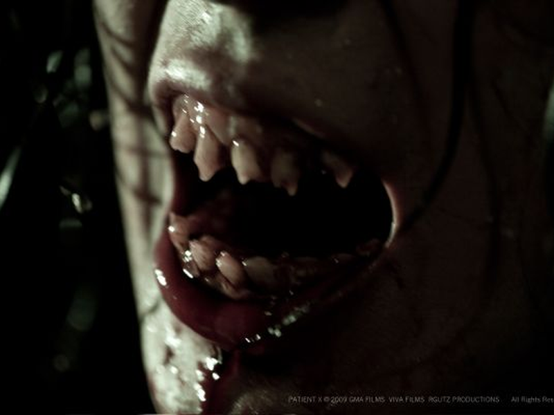 Foto 3 de Patient X