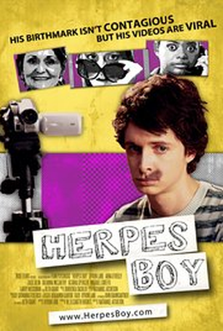 Poster 1 de Filme Herpes Boy (2009)