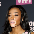 Winnie Harlow