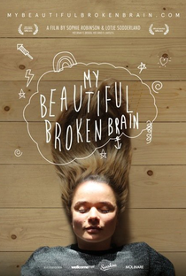 My Beautiful Broken Brain - Poster / Capa / Cartaz - Oficial 3