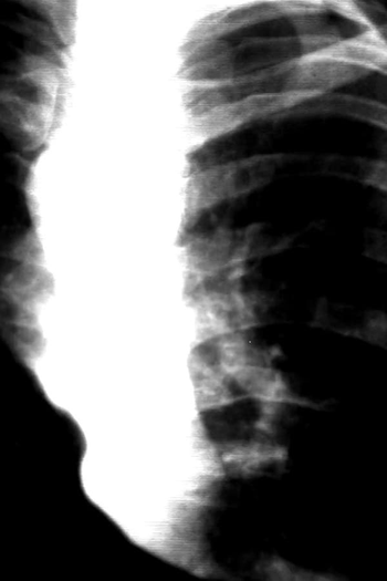 Poster de Curta Tear Gas (2019)