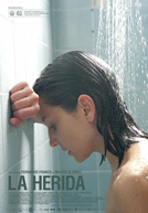 A Ferida