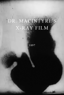 Dr. Macintyre’s X-Ray Film - Poster / Capa / Cartaz - Oficial 1