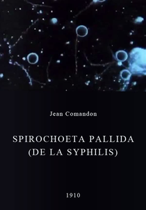 Spirochoeta pallida (de la syphilis) (Spirochoeta pallida (de la syphilis))