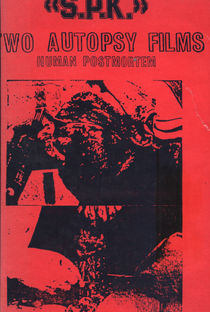 S.P.K.: Two Autopsy Films: Human Postmortem - Poster / Capa / Cartaz - Oficial 1