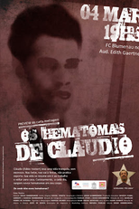 Os Hematomas de Cláudio (Os Hematomas de Cláudio)