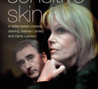 Sensitive Skin (2ª Temporada)